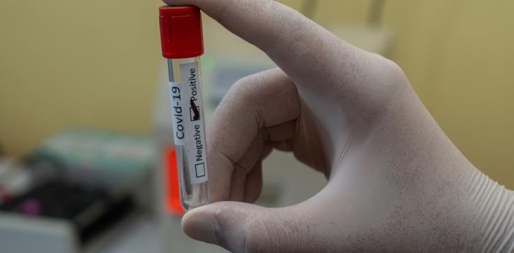 <span>Photo by <a href="https://unsplash.com/@lomash_s?utm_source=unsplash&utm_medium=referral&utm_content=creditCopyText">Prasesh Shiwakoti (Lomash)</a> on <a href="https://unsplash.com/s/photos/covid-19?utm_source=unsplash&utm_medium=referral&utm_content=creditCopyText">Unsplash</a></span> Covid